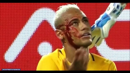 Brutal Elbows in Football   HD