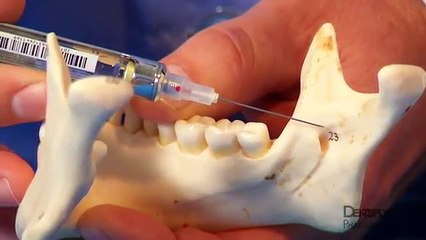 Mandibular Anesthesia Injection Techniques _ DENTSPLY Pharmaceutical