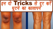 Knees Blackness removal DIY pack | घूटने का कालापन | How to remove knee blackness | BoldSky