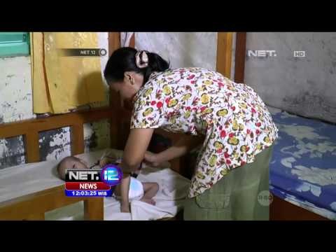 5 Balita Pasien Gizi Buruk di Nias Masih di Rawat - NET12