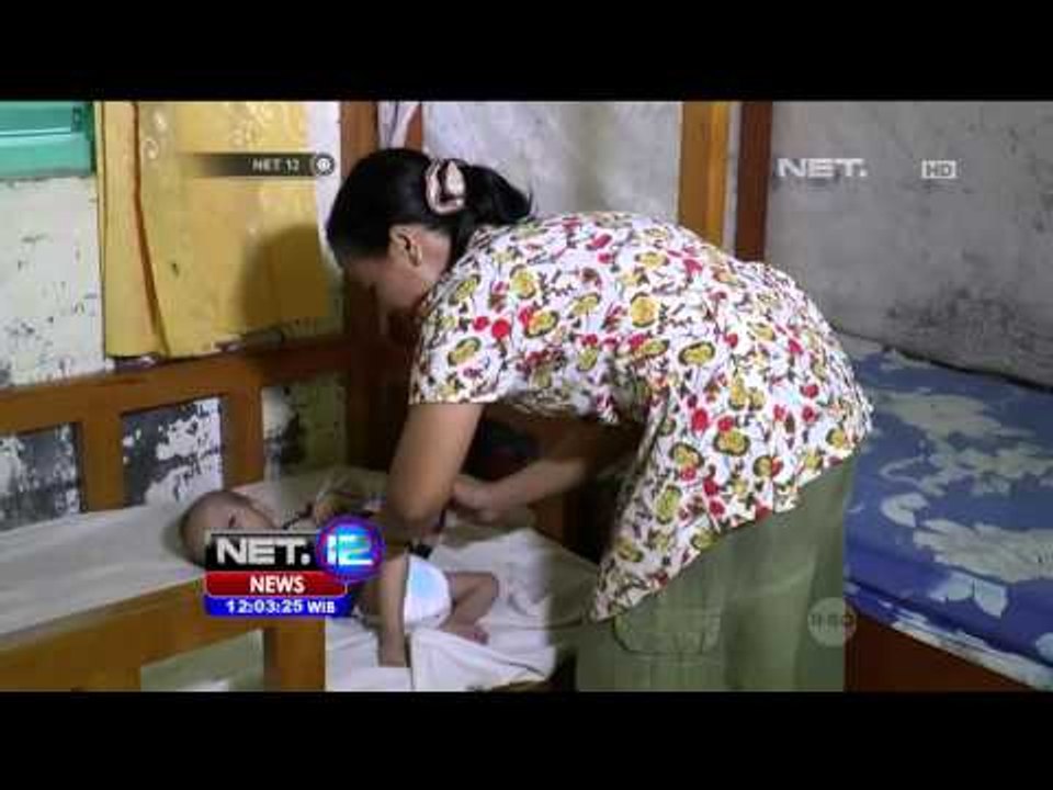 5 Balita Pasien Gizi Buruk di Nias Masih di Rawat - NET12