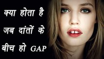 Gap between teeth; Know interesting facts | क्या होता है जब दांतों के बीच हो गैप | Boldsky