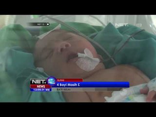 Empat Bayi Kelainan Jantung di Surabaya Masih Dirawat - NEt12