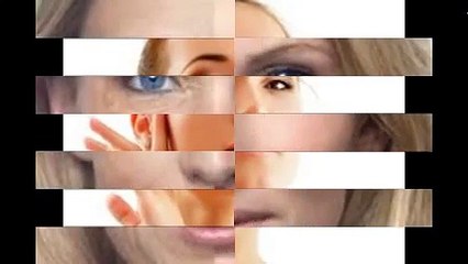 Căng da mặt nội soi an toàn và hiệu quả