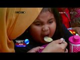 Waspadai Obesitas Pada Anak Sejak Dini - NET5