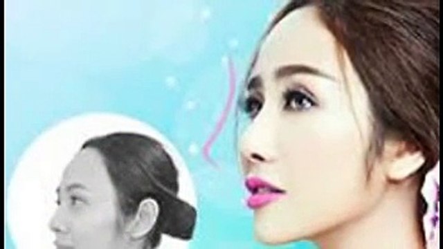 bấm mí mắt o dau dep - Thẩm mỹ viện Hà Nội