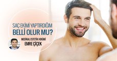 Saç Ekimi Yaptırdığım Belli Olur Mu?