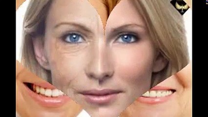 Căng da mặt nội soi lấy lại vẻ đẹp tuổi thanh xuân