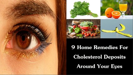 9 Home Remedies For Cholesterol Deposits Around Your Eyes