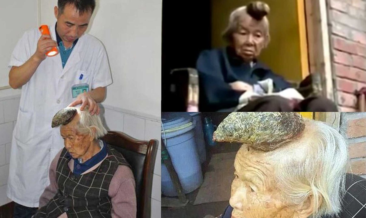 El extraño caso de "la mujer unicornio" en China
