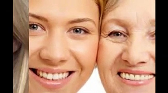 Căng da mặt nội soi làn da căng mịn bất ngờ