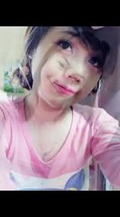 bấm mí được bao lâu - Thẩm mỹ viện Hà Nội