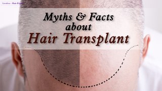 Hair Transplant Facts For Treating Hair loss & Hair Thinning Problem-Limitless Hair Expert.