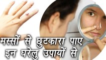 How to Remove warts with Home Remedies, घरेलु उपायों से पाए मस्सों से छुटकारा | Boldsky