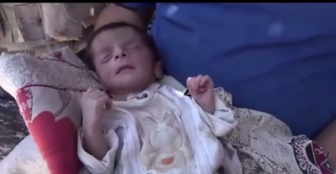 Newborn Taken to Hospital as Iraqi Forces Continue Advancing in Old Mosul