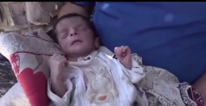 Newborn Taken to Hospital as Iraqi Forces Continue Advancing in Old Mosul