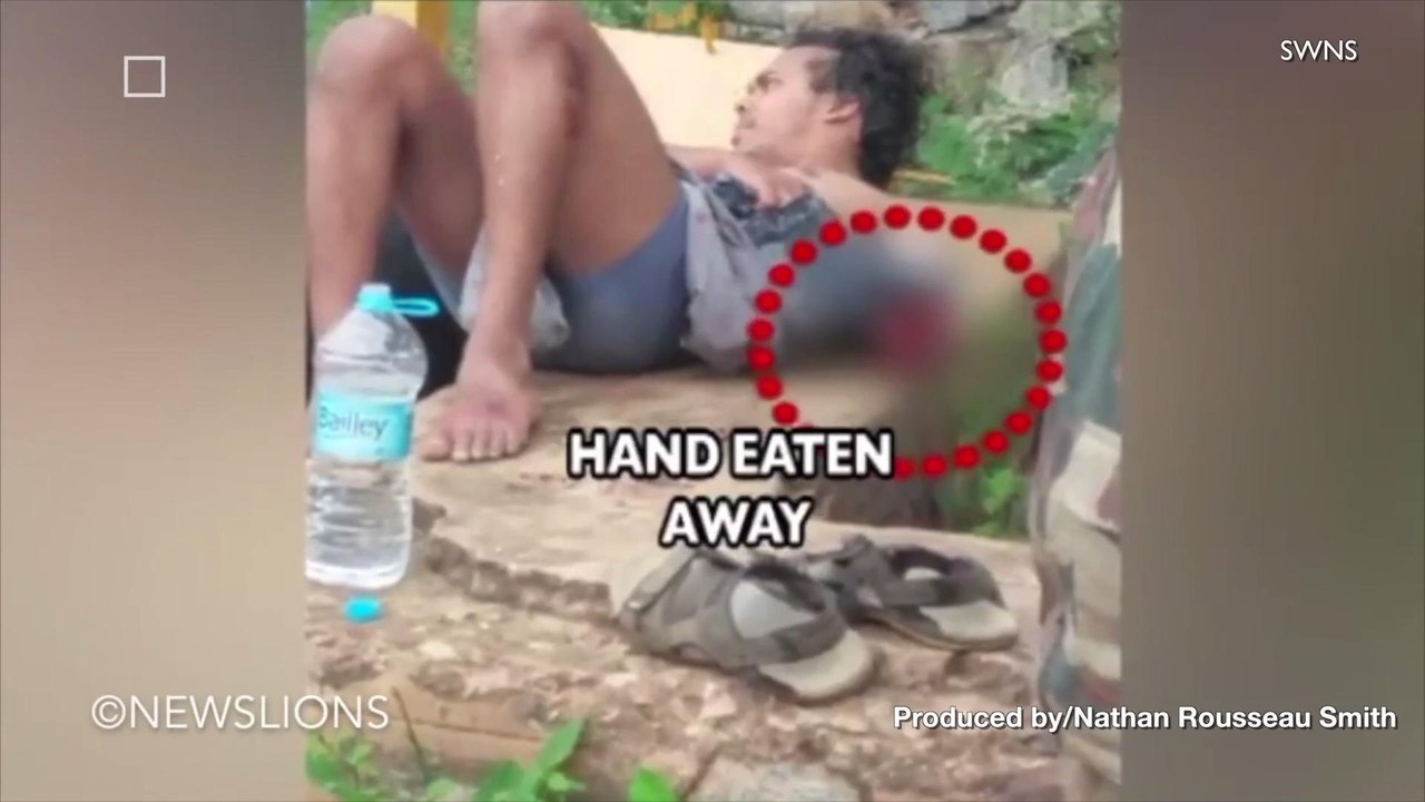 Man Loses Arm to Crocodile Then Gets Fined for It