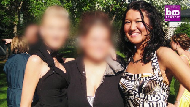 Elle devient mannequin malgré sa maladie qui rend sa peau élastique