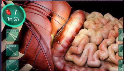 Let's play operate now hospital part 6