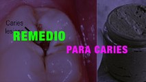 Mira esta receta, remedios naturales, blanqueo dientes, caries, encias...