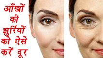 Eye wrinkle | How to remove wrinkle around eyes |आँखों की झुर्रियों को ऐसे करें दूर | Boldsky
