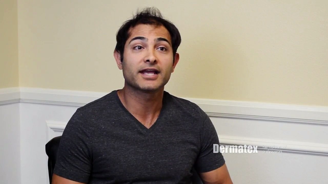 Mens Non Surgical Hair Replacement San Diego & Orange County CA