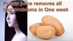 एक सप्ताह में आलू का रस आपके बालों की हर समस्या का जड़ से इलाज करेगा ! Potato juice removes all hair problems in one week