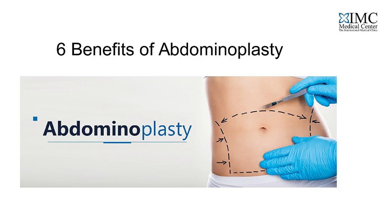 6 Benefits of Abdominoplasty