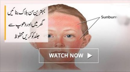 Best home made Sun Block Lotion، cream, gel