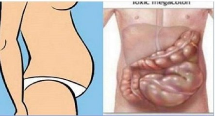 BEBA ISSO E ACABE COM A BARRIGA INCHADA E DURA-BEBIDA PODEROSA