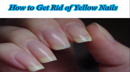 How to Rid of Yello Nails