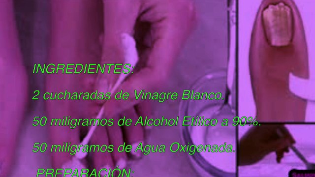 Le llaman el “ROMPE HONGOS”, Elimina todos los hongos de las uñas...