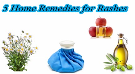 Home Remedies for Rashes