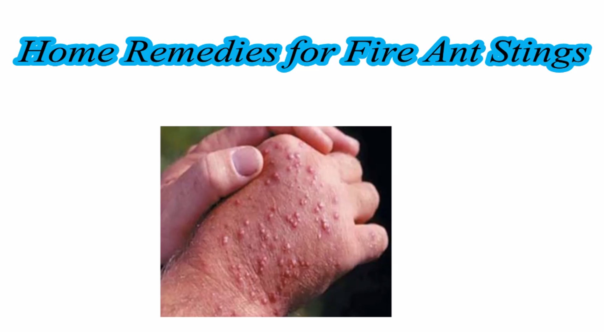 ⁣Remedies for Fire Ant Stings