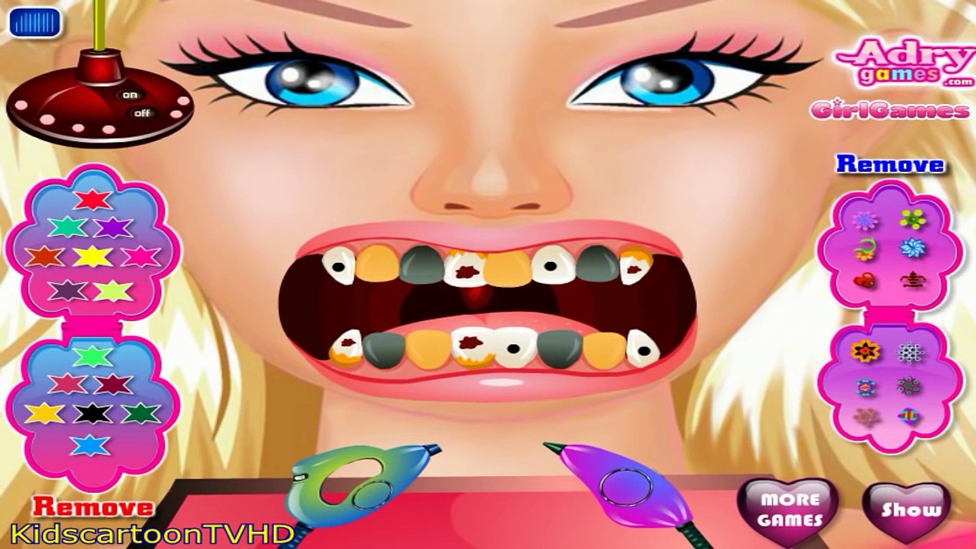 barbie doctor teeth games