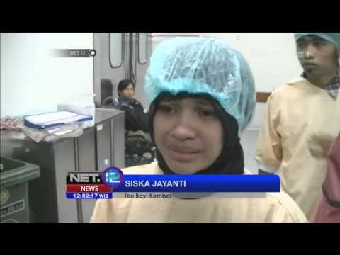 Operasi Pemisahan Bayi Kembar Siam - NET12
