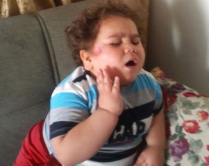 Minik Fenomen "Çitos Efe" Kaza Geçirdi