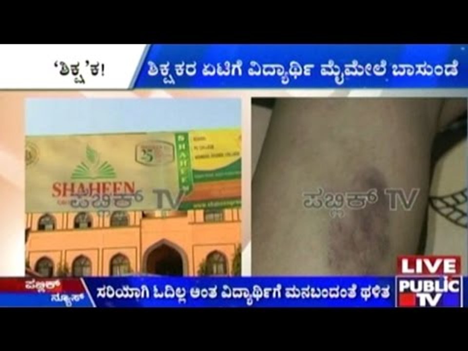 Bidar: Teacher Of Shaheen School Brutally Beats Up Student For Not Studying