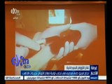 #غرفة_الأخبار | نجاح فريق طبي مصري في تجارب أولية لعلاج الأورام بجزيئات الذهب