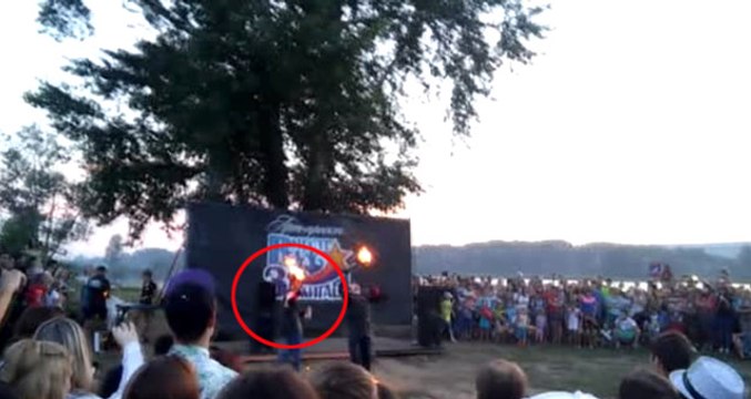 Ateş Cambazı Elindeki Meşaleye Üflediği An Alevler İçinde Kaldı