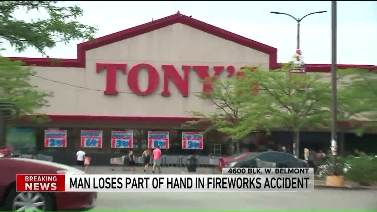 Chicago Man Loses Three Fingers in Fireworks Accident
