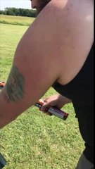 What Could Go Wrong Shooting Fireworks at a Friend?