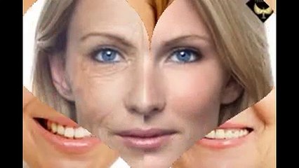 Căng da mặt nội soi an toàn và nhanh chóng