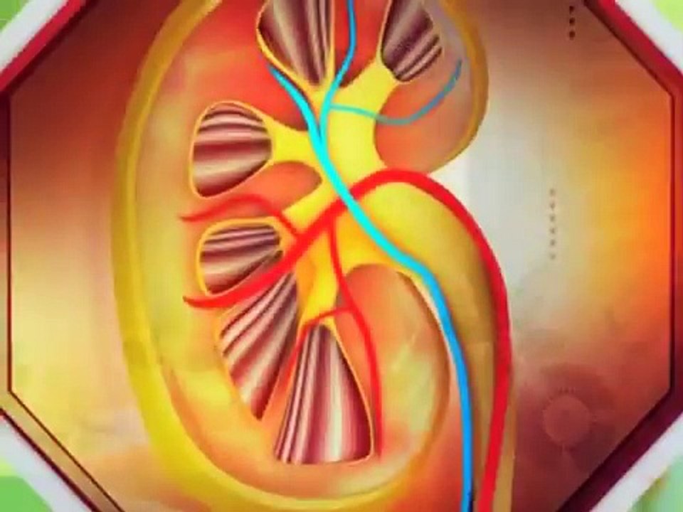 Ayurvedic Treatment for Kidney Disease- Stop kidney dialysis -KIDNEY FALIURE TREATMENT