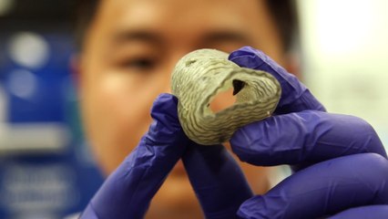 This 3D-Printed Heart Valve Could Save Lives