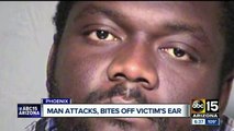 Man attacks wheelchair-bound man, bites ear off