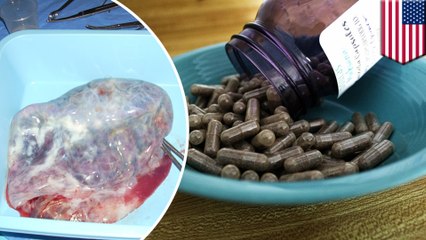 Eating placenta may put your baby’s health at risk, warns CDC