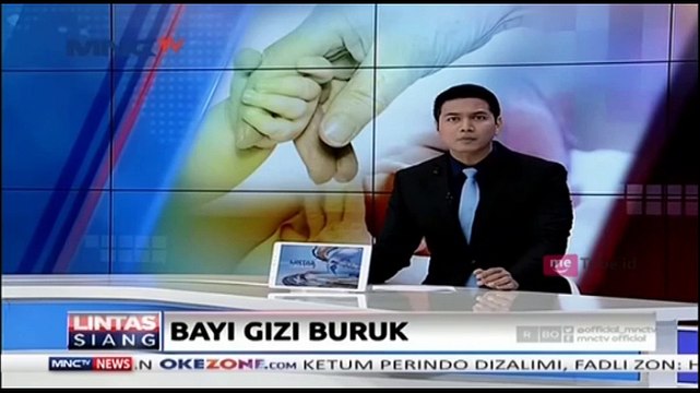 Fatimah, Bayi Penderita Gizi Buruk di Gunung Kidul