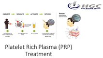 Platelet Rich Plasma (PRP) Treatment