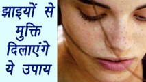 Dark Spots removal Home Remedy | इन उपायों से पाएं झाइयों से छुटकारा | Boldsky